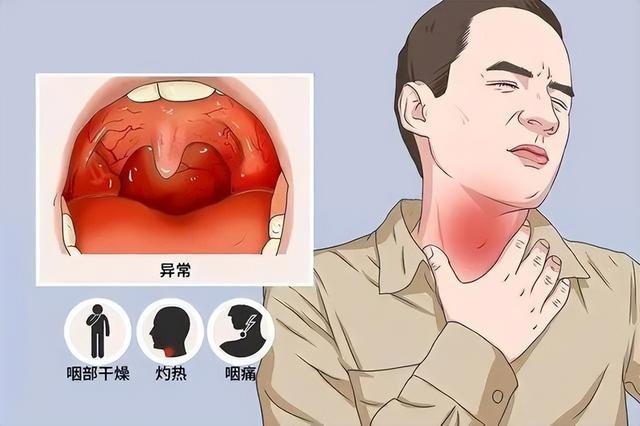 甲流去世的人越来越多！提醒：最好不要做这7件事，以免身体不适