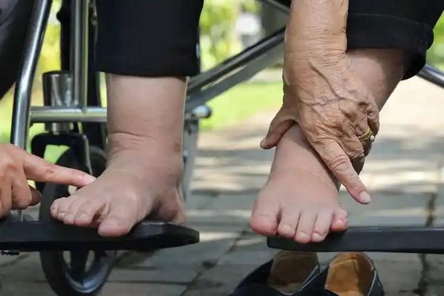 医生发现：最伤害肾脏的行为，不是憋尿！而是频繁去做这3件事