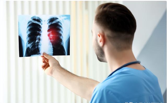医生解剖80名肺癌死者，研究发现：患肺癌的人，有6大共性！