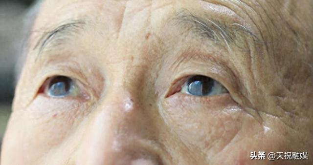 眼睛是“脑梗”的放大镜？医生说：眼睛若有这4个异常，及时就医