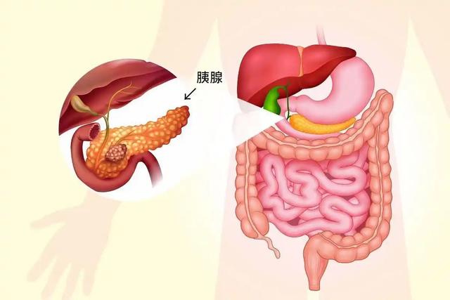 这3类糕点正偷偷摧毁你的胰腺！医生再劝：不论年事，都少吃些