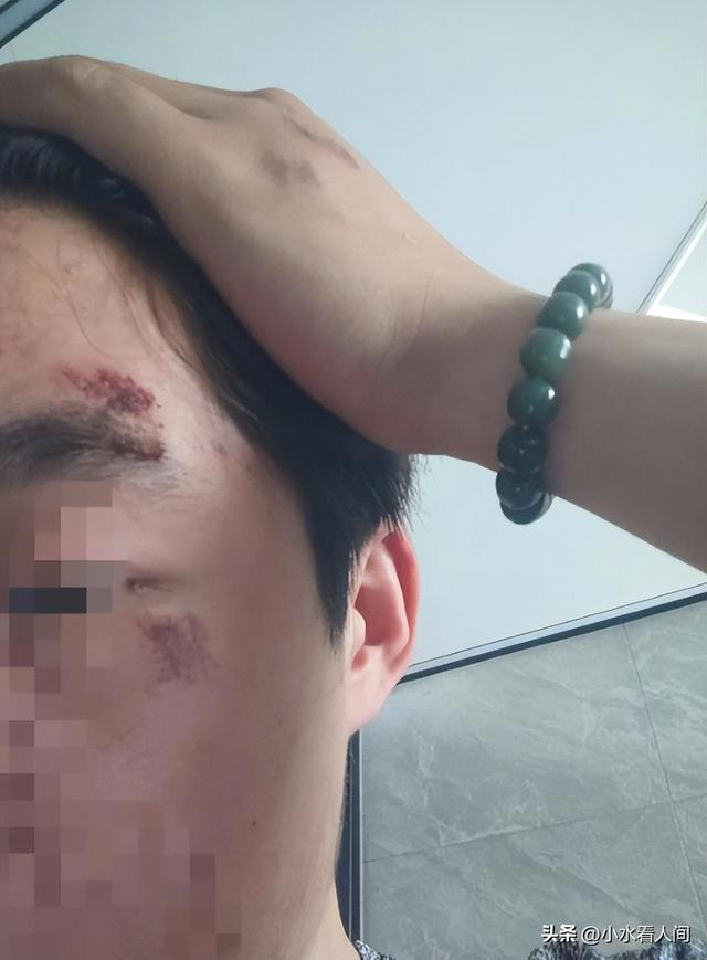 夫君被别车遭群殴后续：刑事案件，谢绝
息争，一家人整整齐齐进去