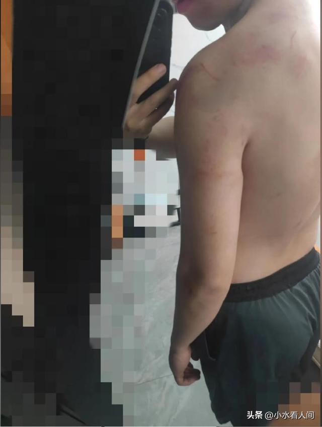 夫君被别车遭群殴后续：刑事案件，谢绝
息争，一家人整整齐齐进去