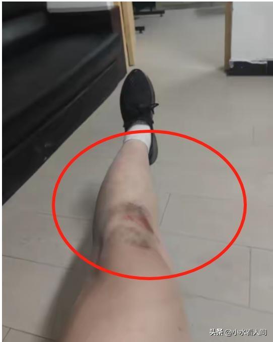 夫君被别车遭群殴后续：刑事案件，谢绝
息争，一家人整整齐齐进去
