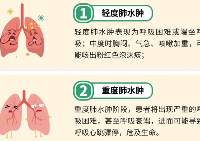 夫君抵达三天高反去世

亡！不是洗浴输液，而是多数人犯的致命运动！