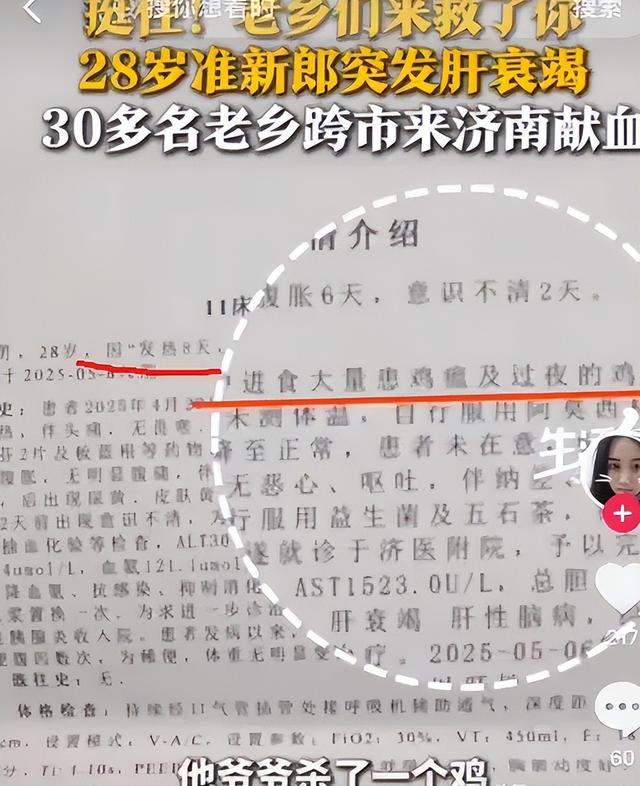 山东准新郎死亡后续，满身换血未保命，病历曝光，死因不但是鸡肉