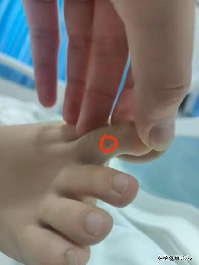 女旅客
被蛇咬身亡后续，身份背景
曝光，观察组介入，俩医院恐担责