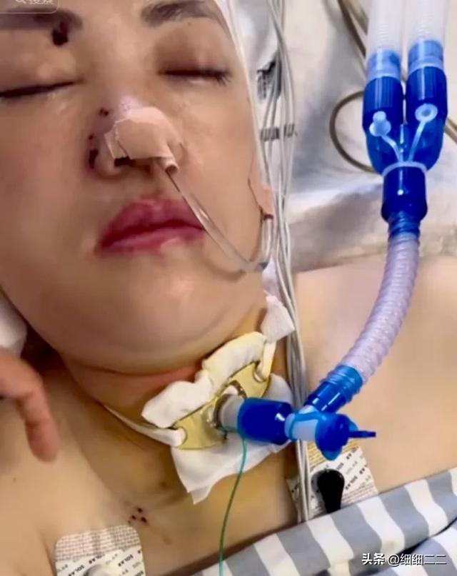 突发！江西玉人网红逝世
，仅48岁，长的很漂亮，生前恶习暴露病因