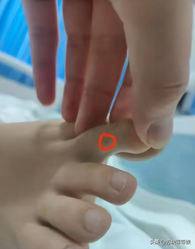 女游客
被蛇咬身亡后续，身份背景
曝光，观察
组介入，俩病院
恐担责