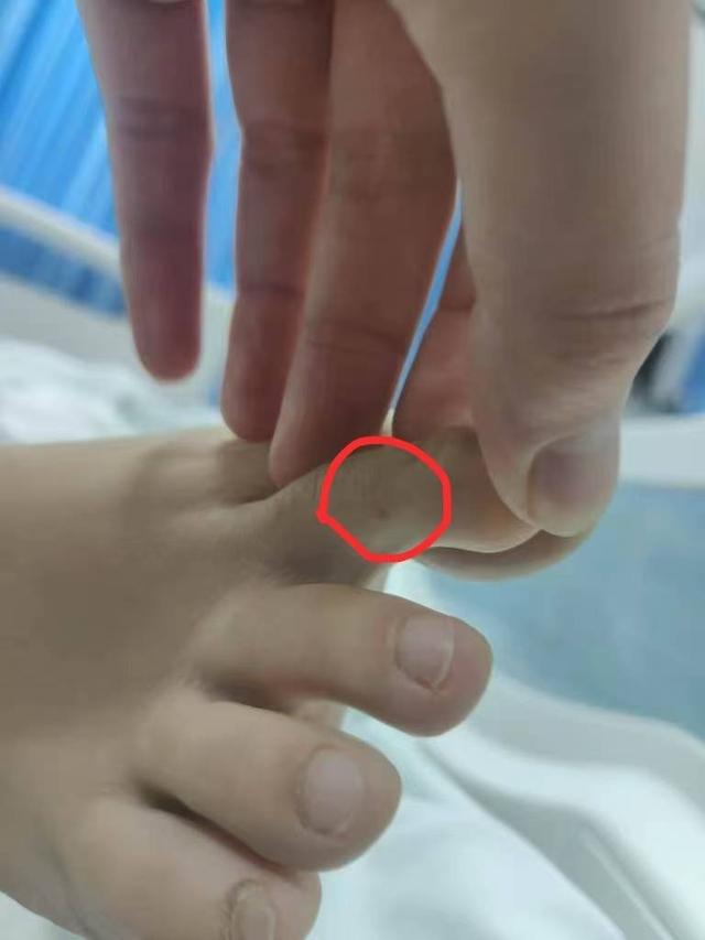 三亚殒命女子家属回应质疑：第二家病院
使用了血清抢救，愿意尸检共同观察