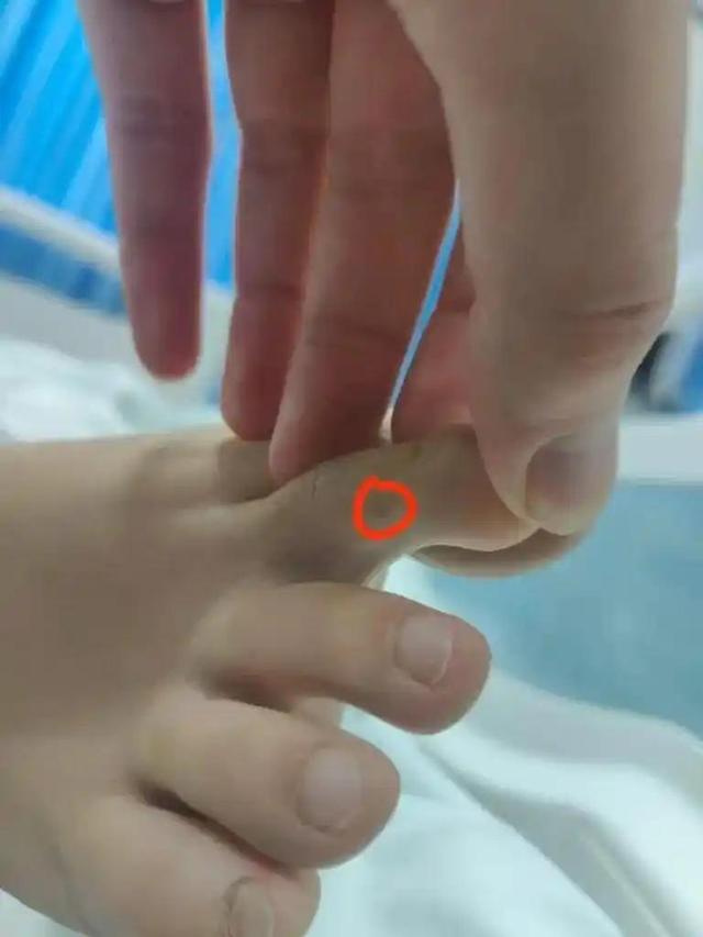 三亚文旅批评区陷落！被毒蛇咬女游客
真正去世

因曝光，游客
们都慌了