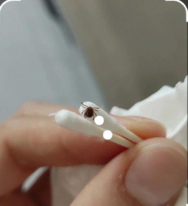 孩子脖子惊现蜱虫，妈妈“两谢绝
”救了娃，年夜
夫：记着三点可救命