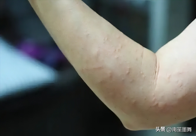 本钱15卖1000！年销30万坑害全国，央视最新曝光，赶紧告诉

家里人