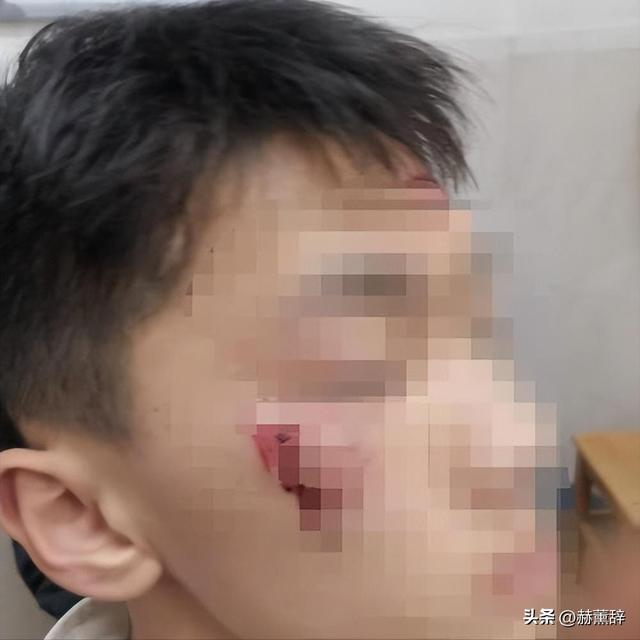 反转！14岁男孩被保安围殴后续，真相曝光，不简朴，家长拒绝调度
