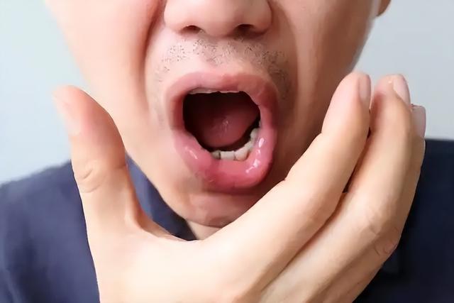 长期吃洋葱，身体不容易涌现
血栓？大夫下令：六类人最好不要吃