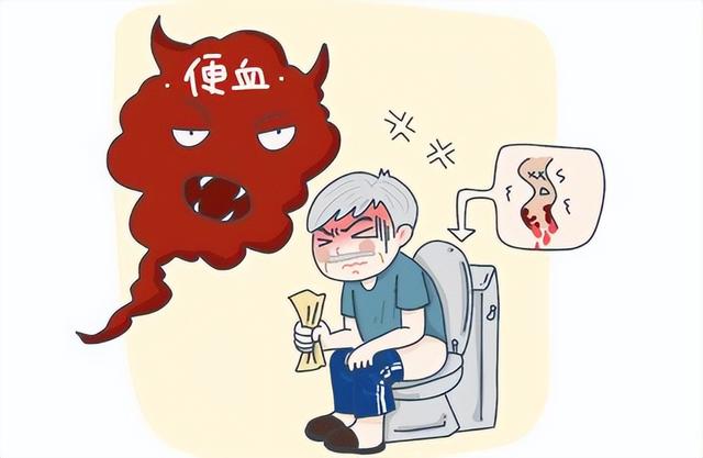大年夜

就是
结肠癌最好的“预警”！提示：出现这3个异常
，多半是肠癌