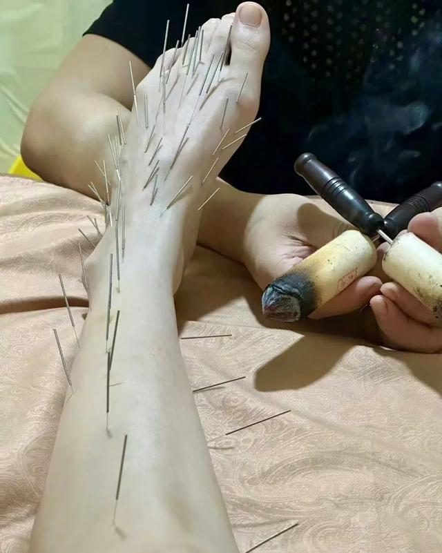 46岁陈乔恩“针雕”后现身！脸上满满胶原蛋白，让人赞叹效果明显