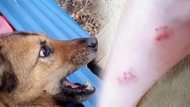 回顾：湖北男子被狗咬伤，打了5针狂犬疫苗，2个月后为何还产生
发火
了