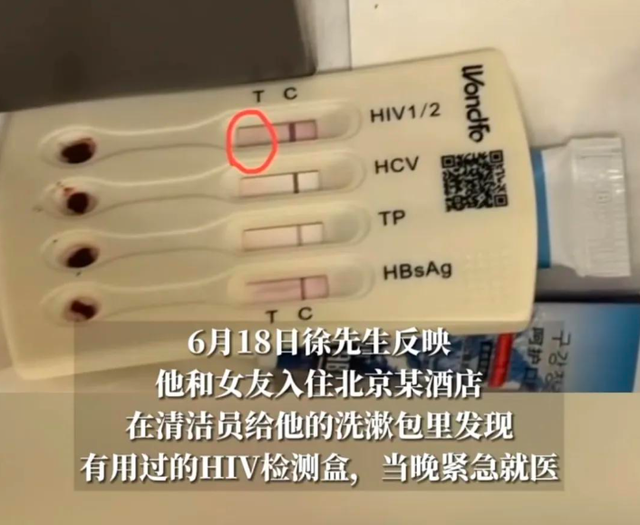 北京旅馆HIV试纸后续：满是人血两条杠！客人紧急就医，细节曝光
