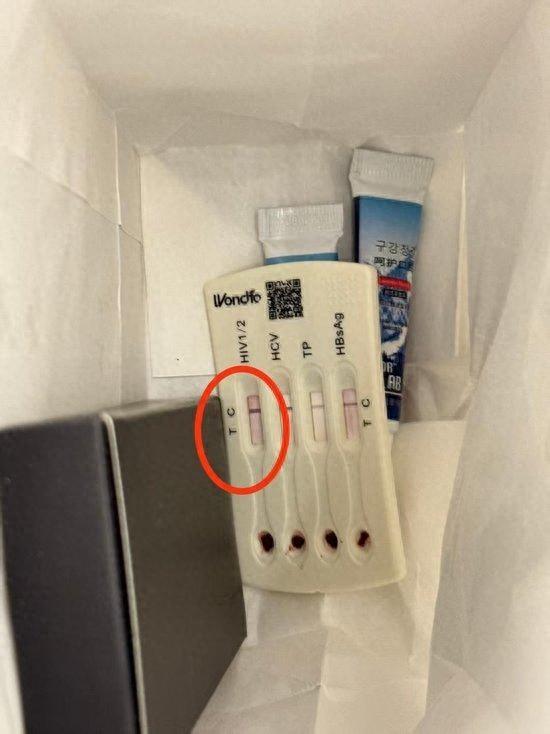 北京旅馆HIV试纸后续：满是人血两条杠！客人紧急就医，细节曝光