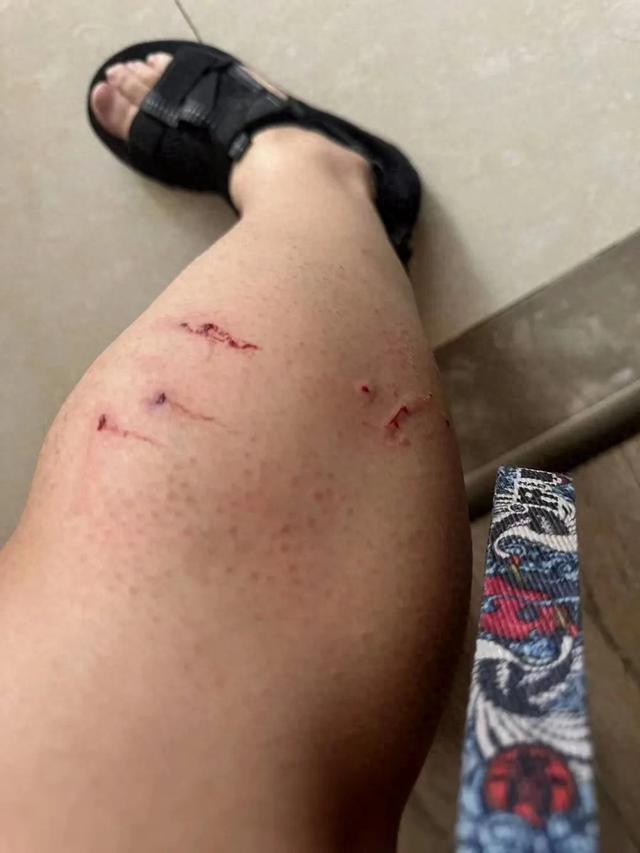 沪上一女子腿上被咬出4个血洞！小区内三五成群、危急四伏，不少人中招